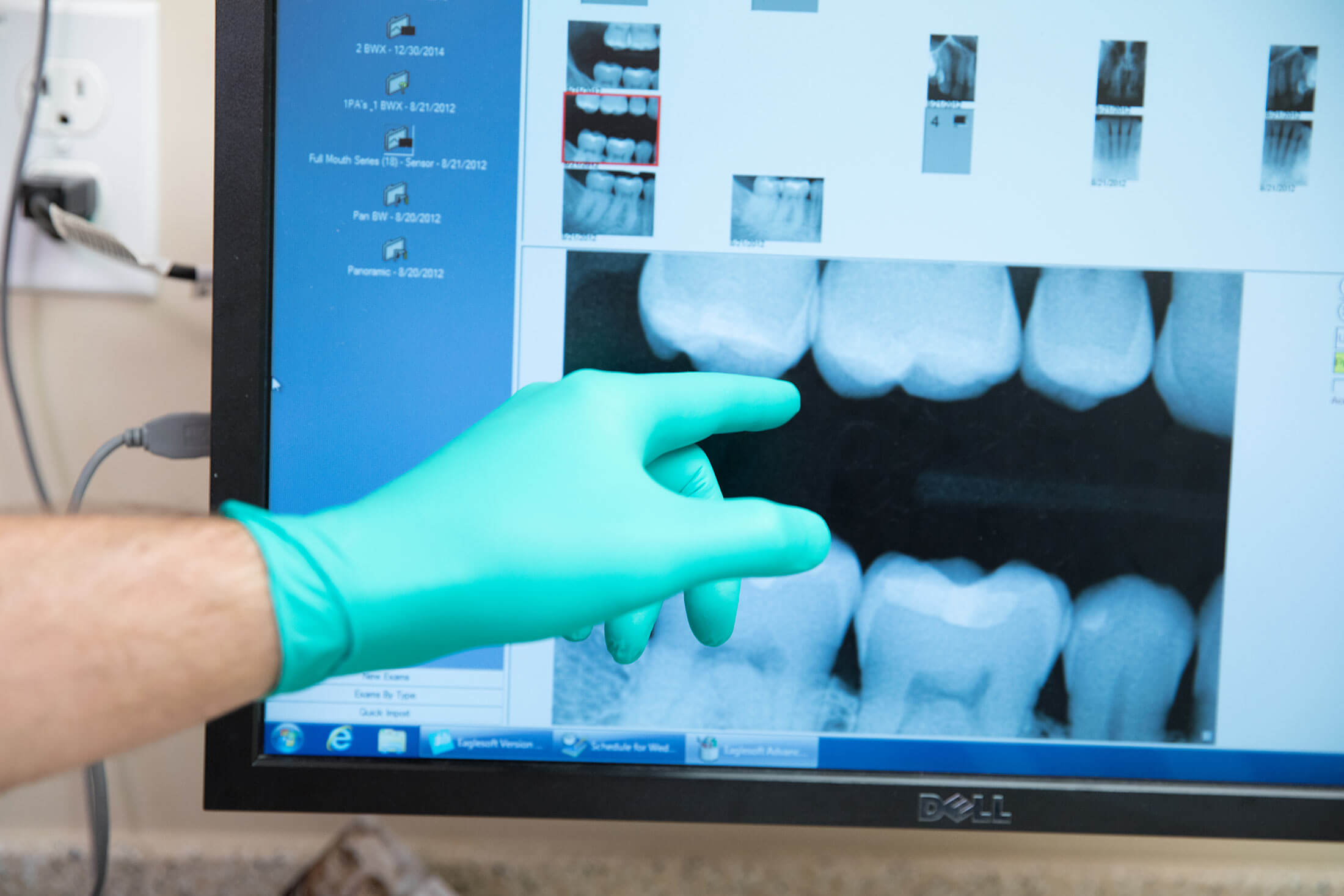 Pleasant Street Dental, dental x-ray